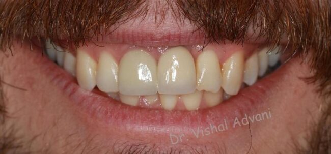 Elk Grove Smile Center - Services