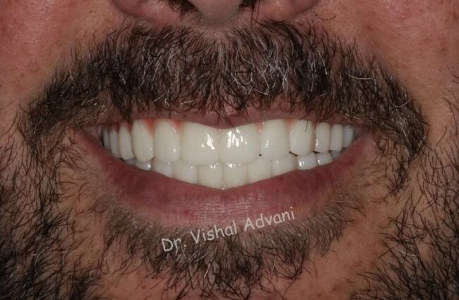 Elk Grove Smile Center - Services