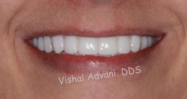 Elk Grove Smile Center - Services