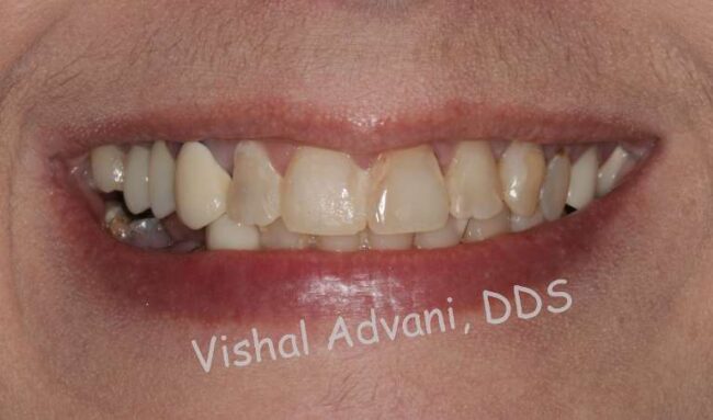 Elk Grove Smile Center - Services