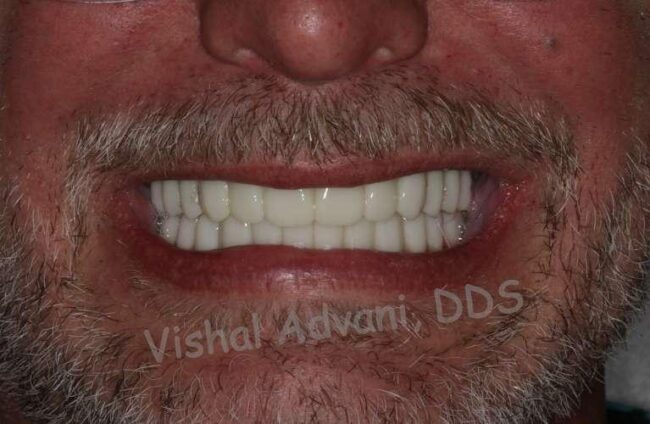 Elk Grove Smile Center - Services