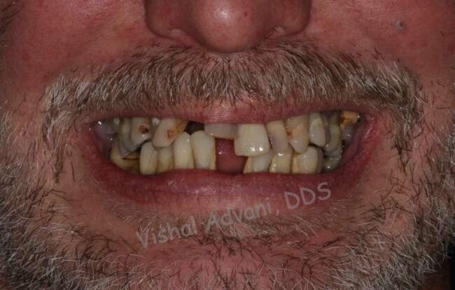 Elk Grove Smile Center - Services